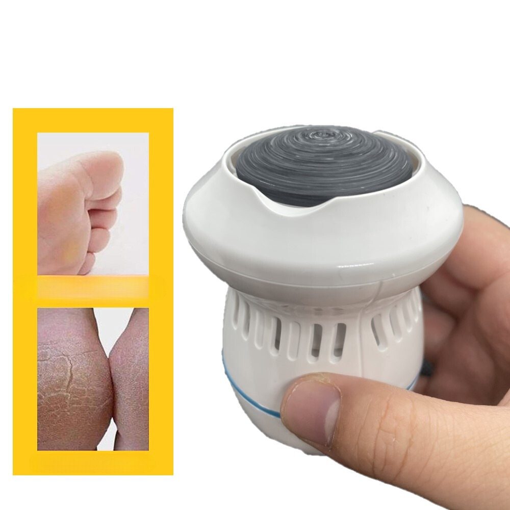 VIMEDA | Electric Foot Grinder™