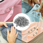 VIMEDA | Snap Lock Kit™ (100 knapper sett)