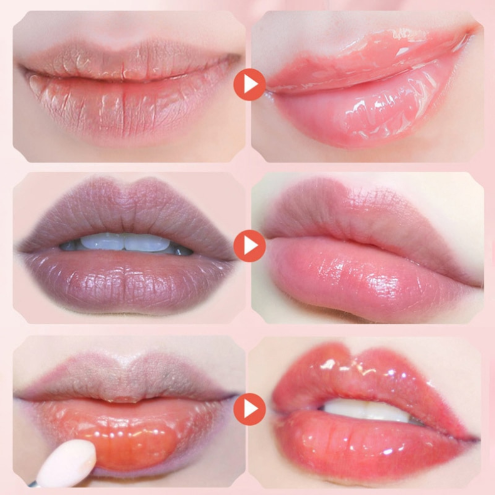 VIMEDA | Honey Lip Balm™ (1+1 GRATIS)