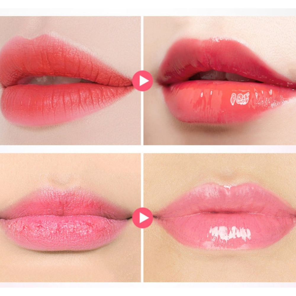 VIMEDA | Honey Lip Balm™ (1+1 GRATIS)