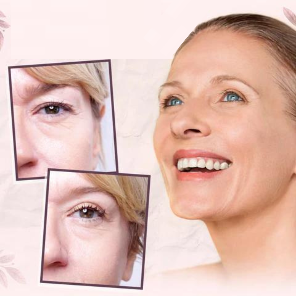 VIMEDA | Eyelid Tape™ (1+1 GRATIS)