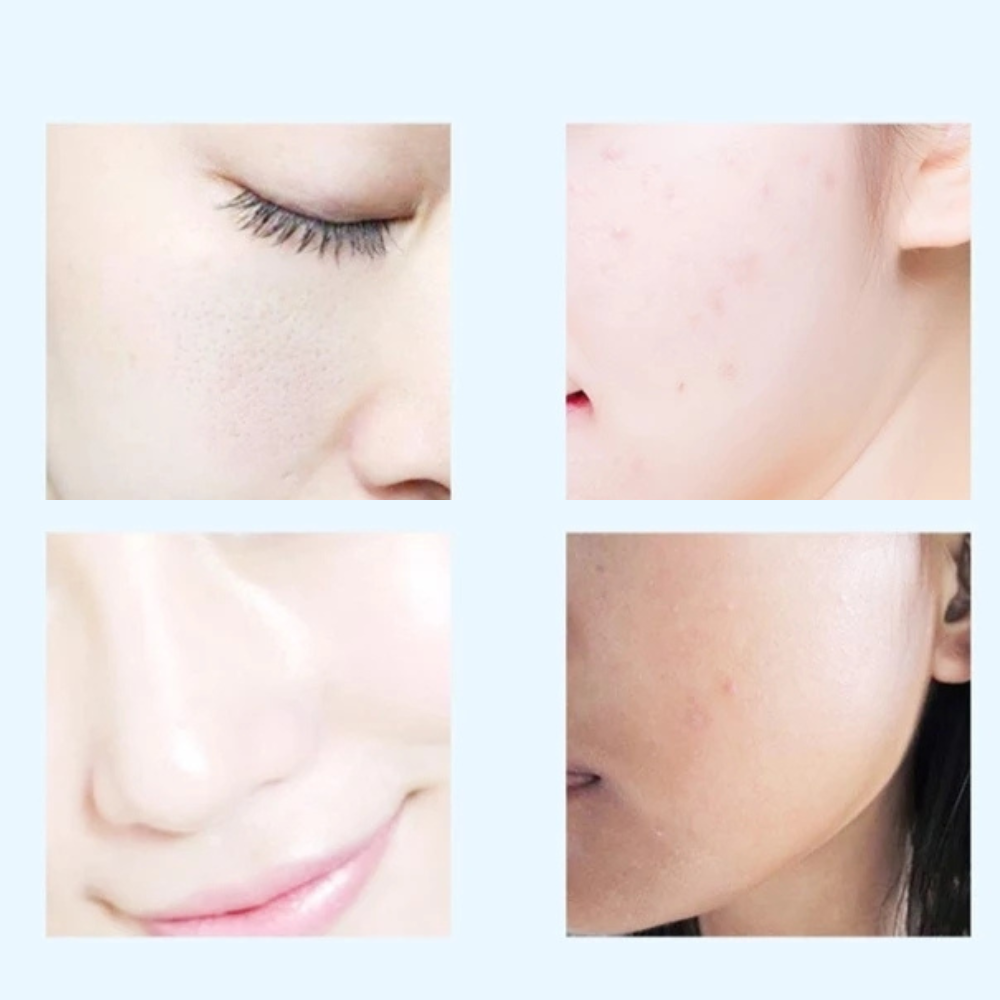VIMEDA | Silicone Exfoliating Brush™