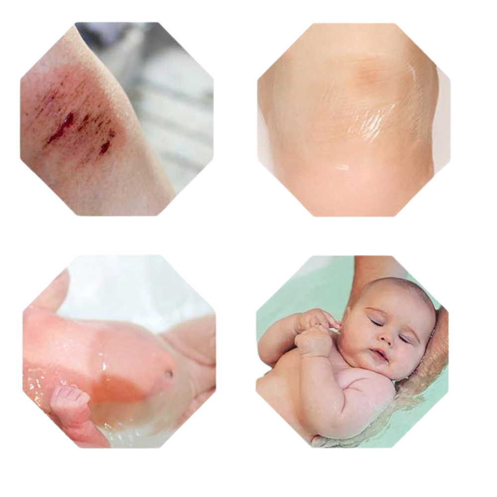 VIMEDA  | Baby Ear Stickers™ (30+30 GRATIS)