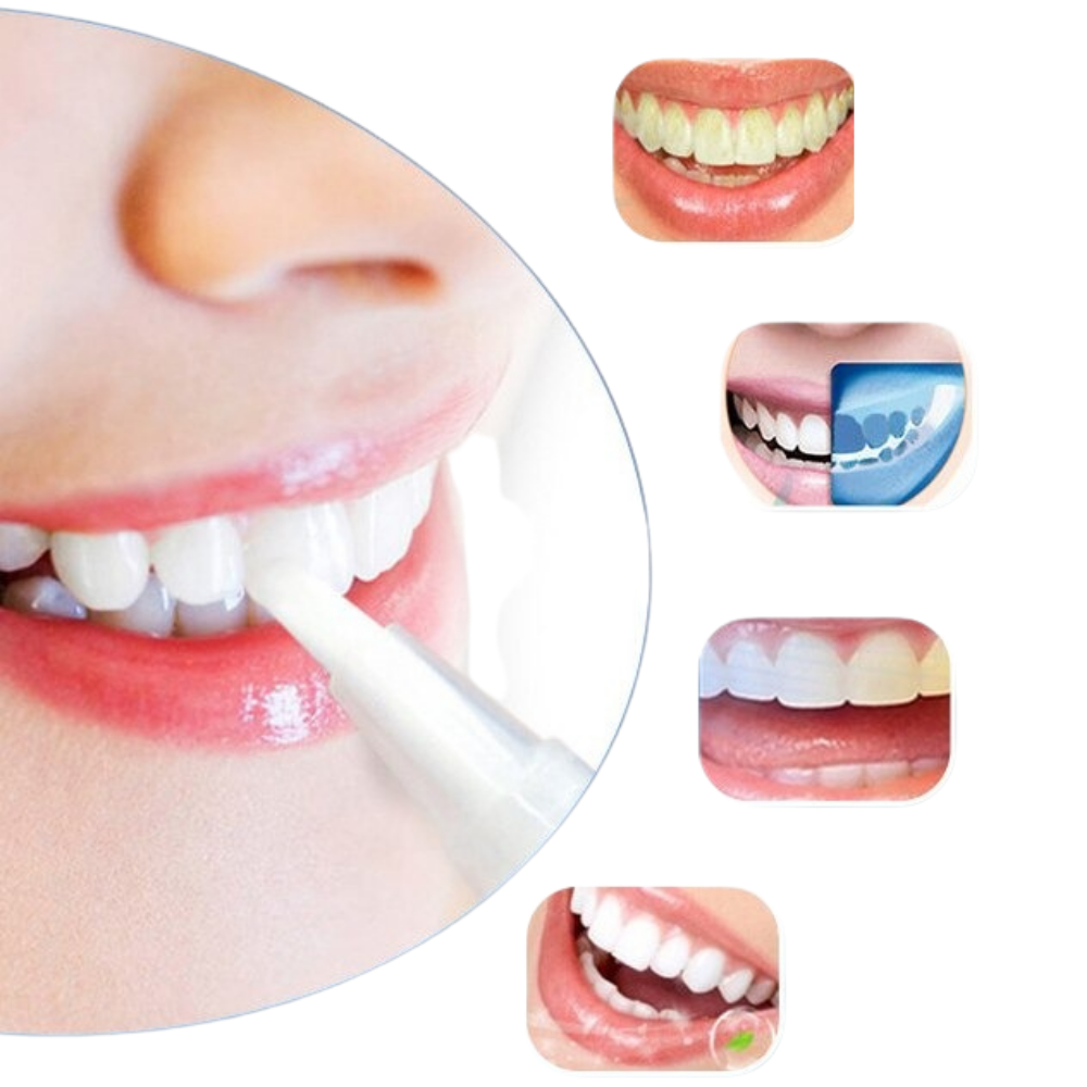 VIMEDA | Teeth Whitening Pen™ (1+1 GRATIS)