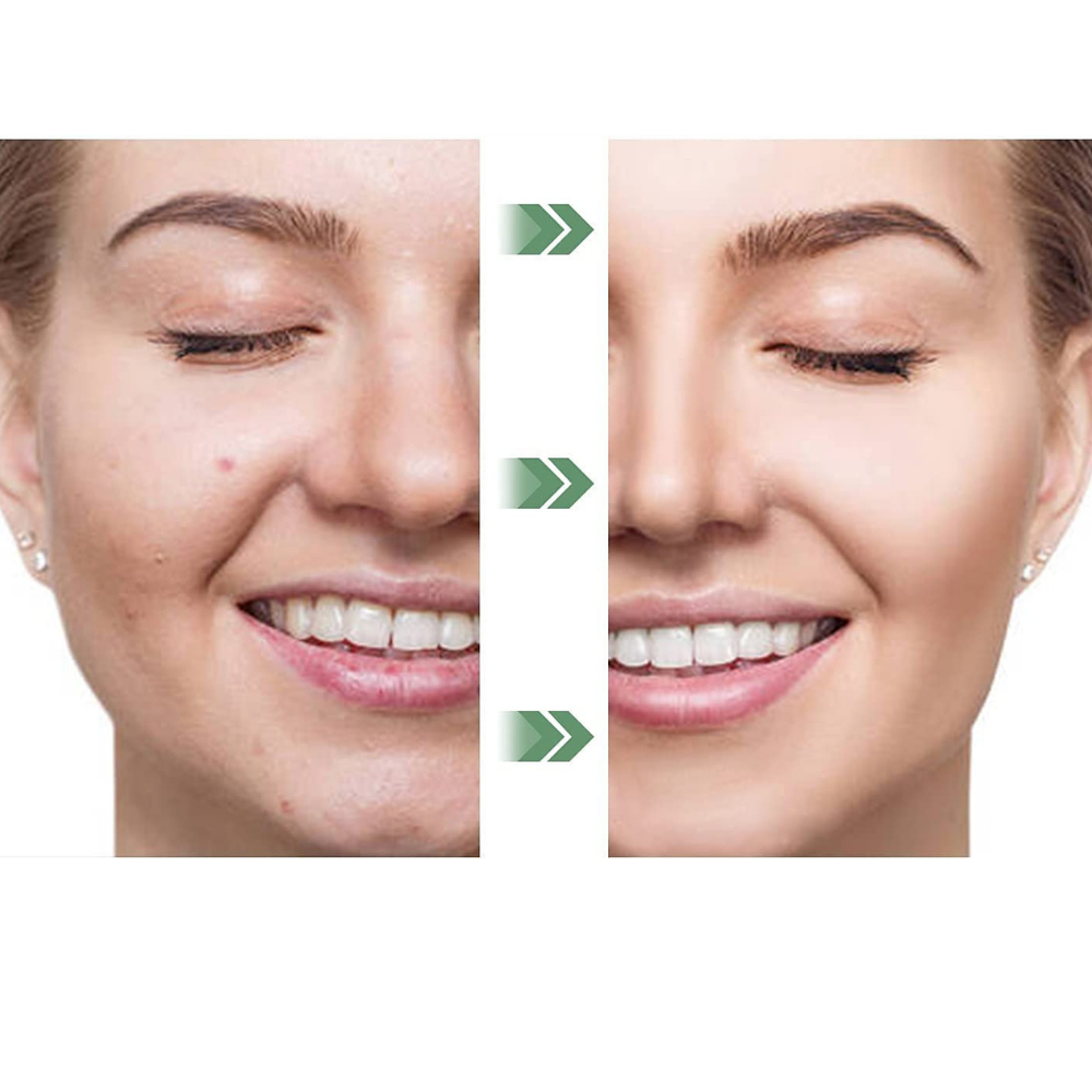 VIMEDA | Green Tea Mask™ (1+1 GRATIS)