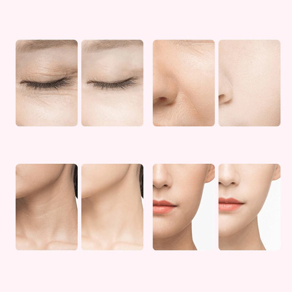VIMEDA | Mini Facial Massager™