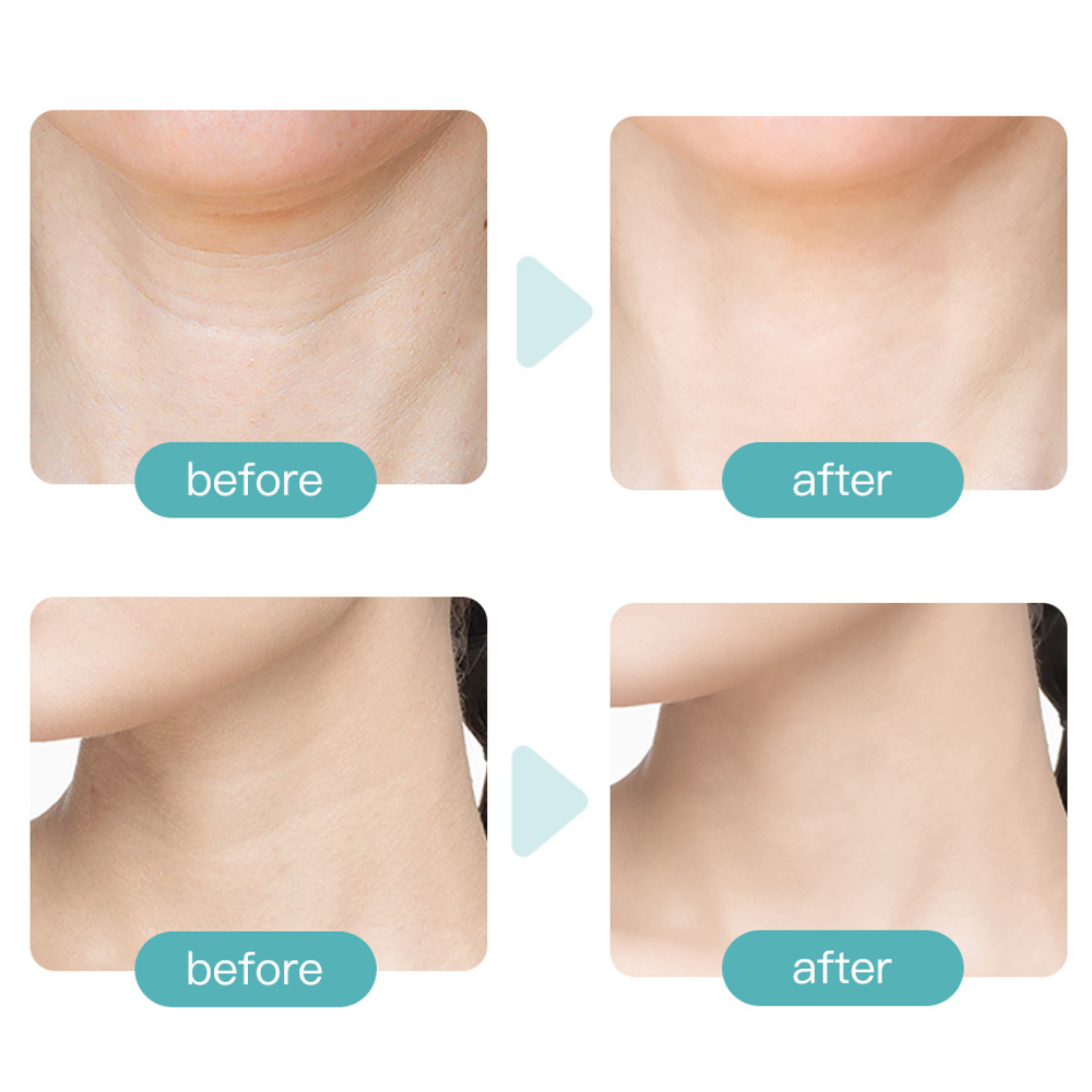 VIMEDA | Facial Massager™