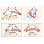 VIMEDA | Teeth Whitening Pen™ (1+1 GRATIS)