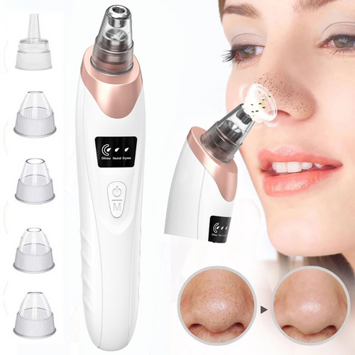 VIMEDA | Blackhead Remover Vacuum™