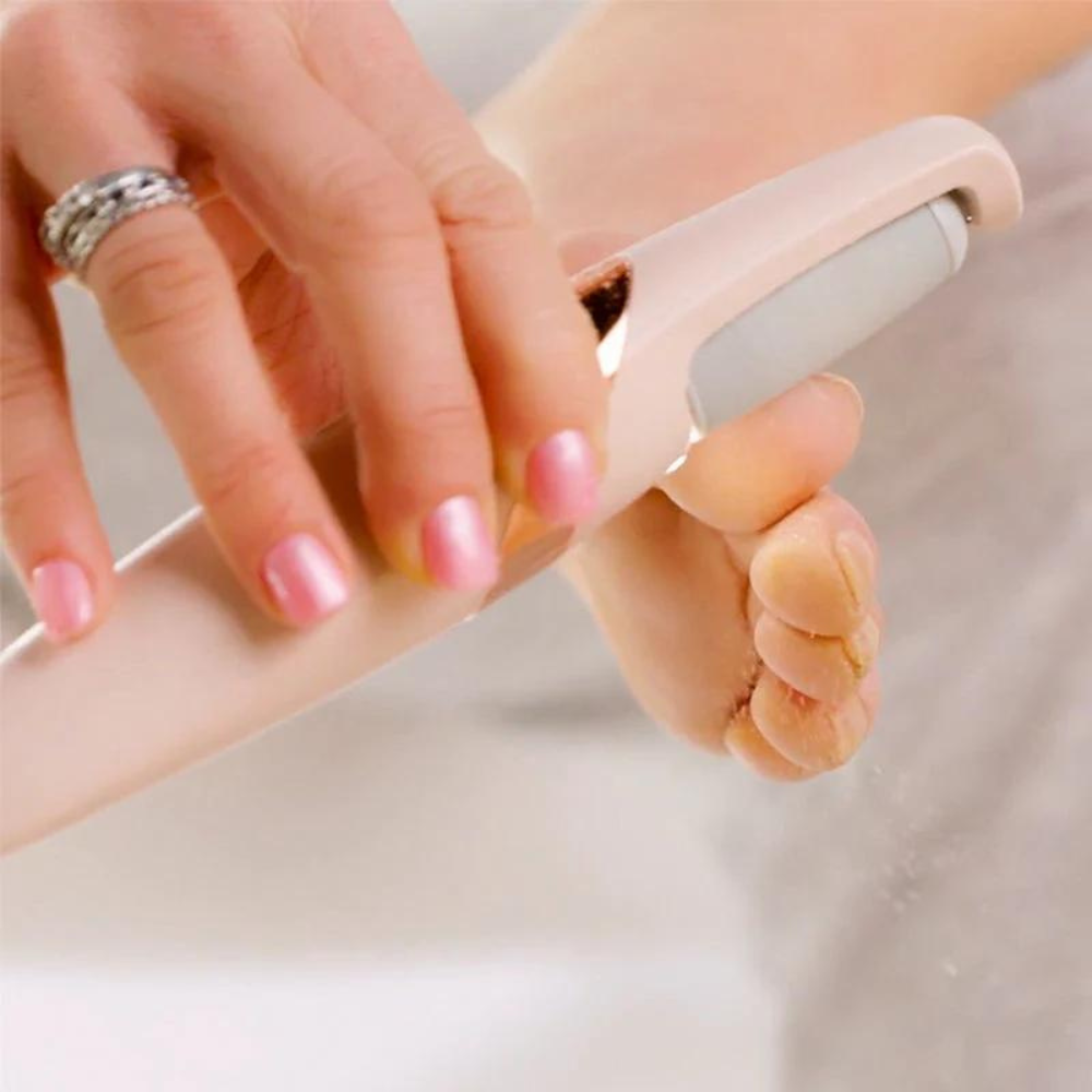 VIMEDA | Electric Foot File™