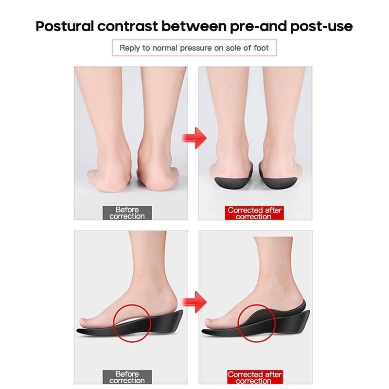 VIMEDA | Foot Correction Insoles™ (1+1 GRATIS)